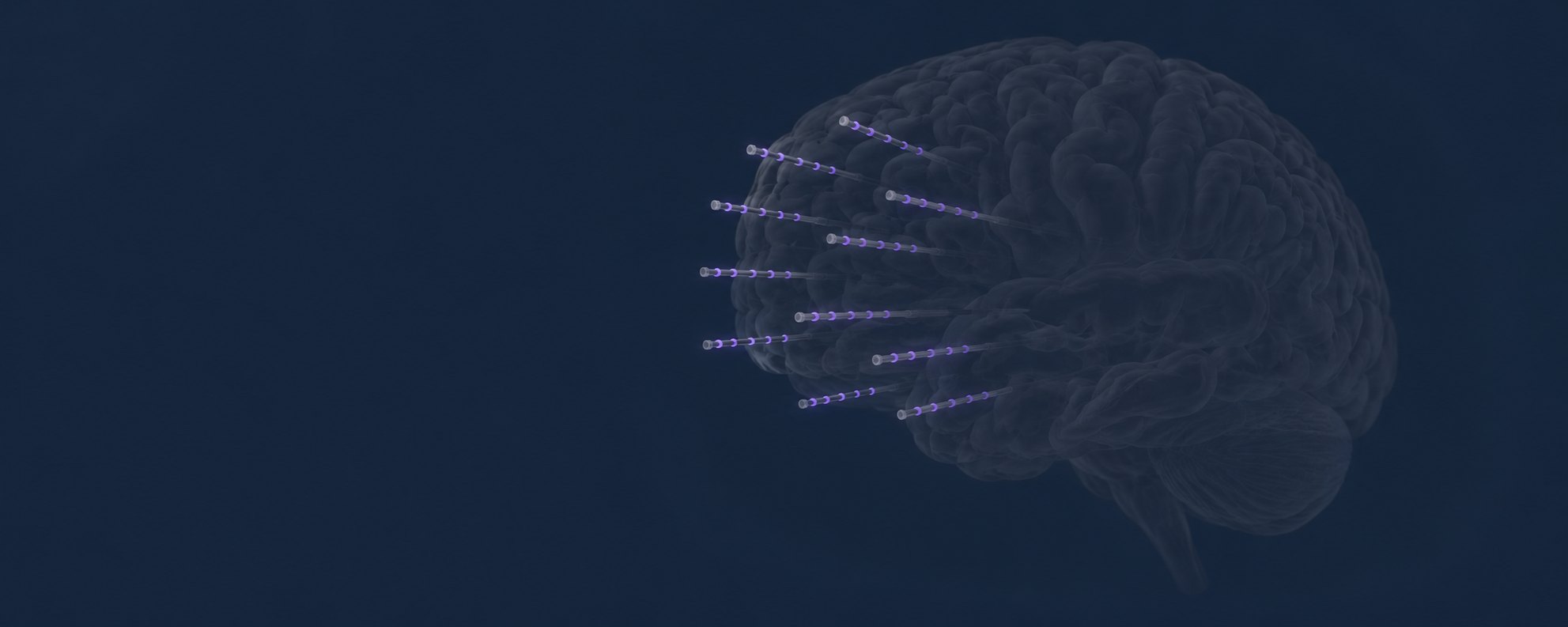 Brain reconstruction with stereo-EEG electrodes